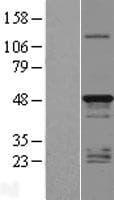 TMEM79 Protein (Over-Expression Lysate Myc-DDK (Flag))