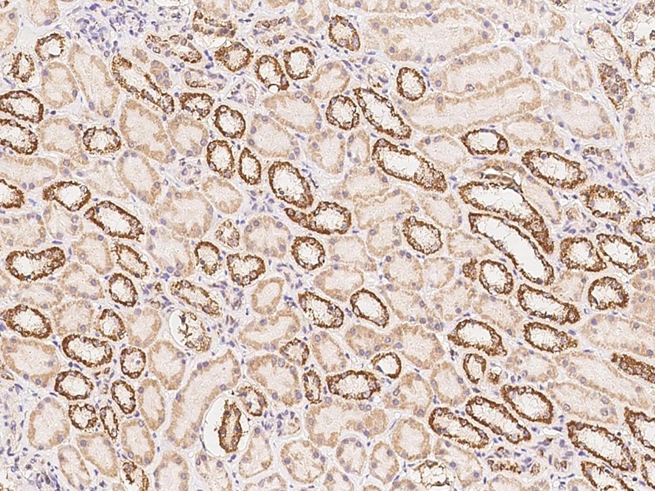 NDUFA10 Antibody