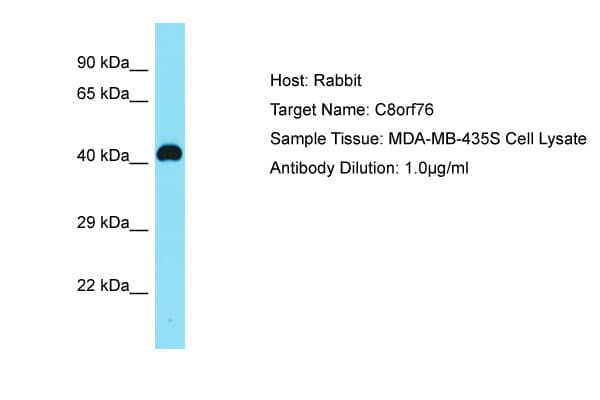 C8orf76 Antibody (aa61-110)