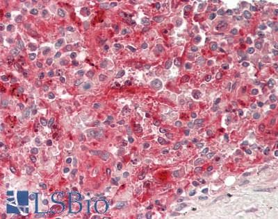 ASAH1 / Acid Ceramidase Antibody (aa287-336)