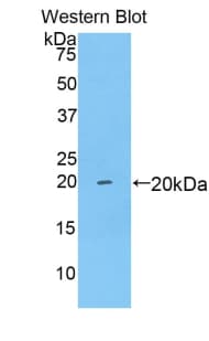BDNF Antibody (aa16-183, FITC)
