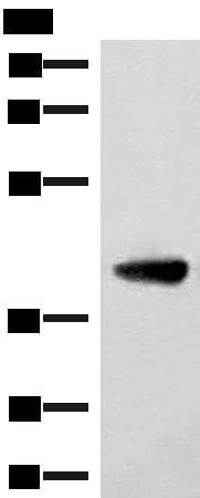 ST8SIA4 Antibody