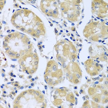 FBXL5 / FBL5 Antibody