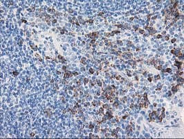 AIPL1 Antibody (clone OTI3B4, Carrier-free)