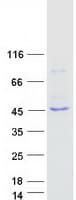 Human L2HGDH Protein (Recombinant Myc-DDK (Flag))