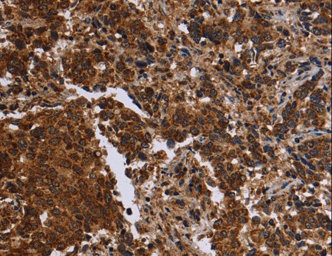 FMN2 / Formin 2 Antibody