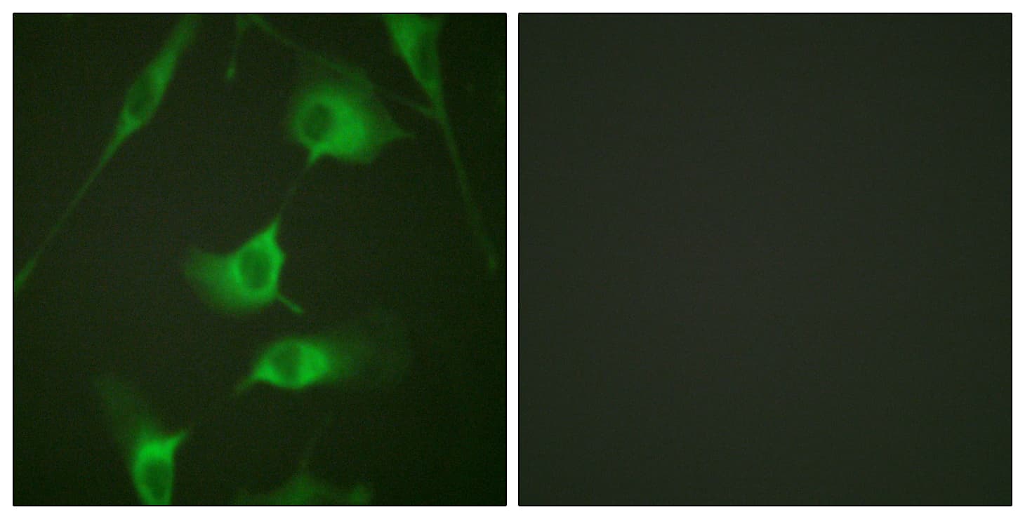 IHC-plus™ KRT8 / CK8 / Cytokeratin 8 Antibody (aa401-450)