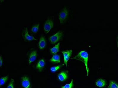 ZDHHC20 Antibody