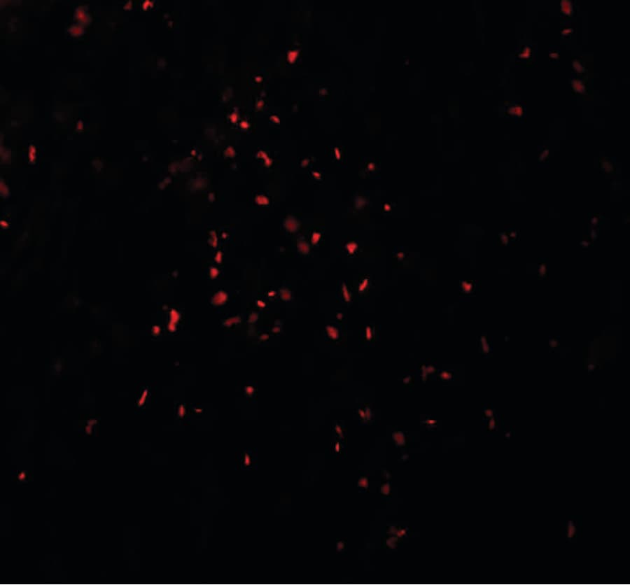 IHC-plus™ Polyclonal Rabbit anti-Human ZBTB7A / Pokemon Antibody (IHC, IF, WB)