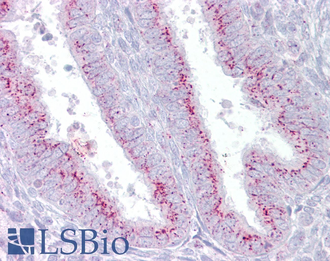 PROS1 / Protein S Antibody (aa251-300, HRP)