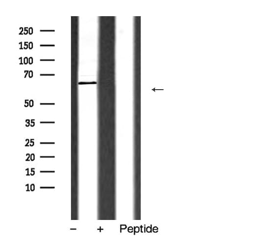 CYP2D6 Antibody