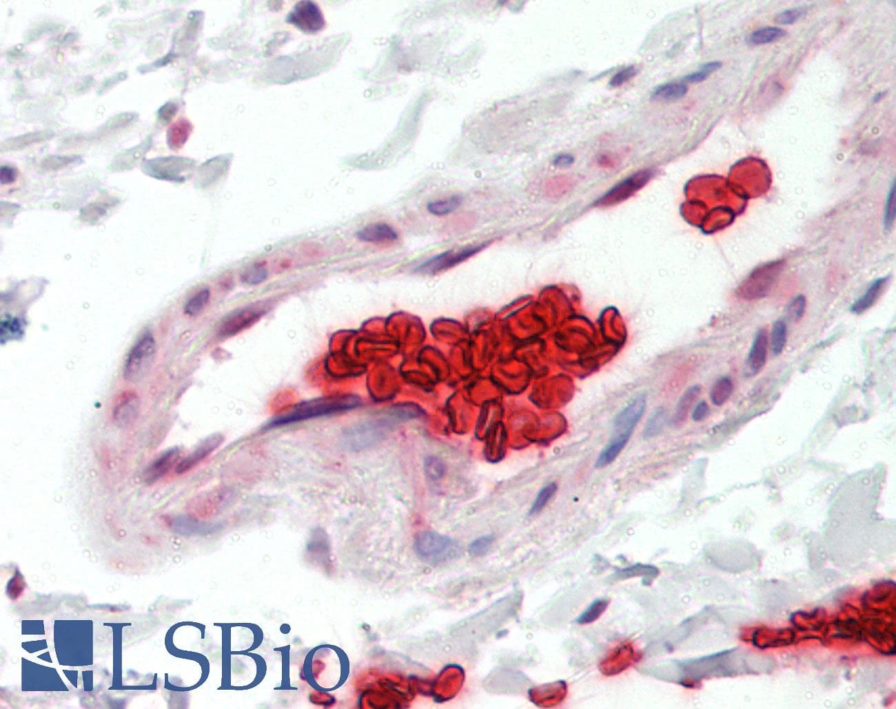 IHC-plus™ GYPA / CD235a / Glycophorin A Antibody (clone YTH89.1)