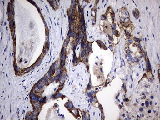 PIK3CD / PI3K Delta Antibody (aa286-610, clone OTI6A12)