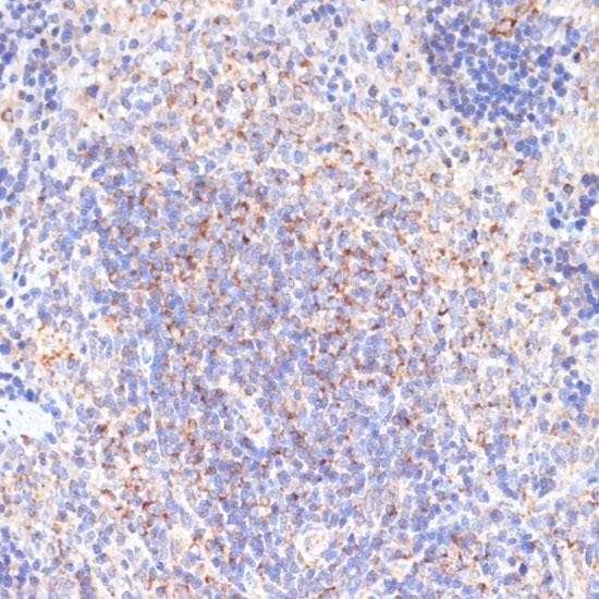 PDGFRB / PDGFR Beta Antibody
