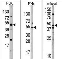 JMJD6 / PSR Antibody (aa1-30)