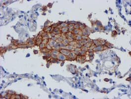 Monoclonal Mouse anti-Human CD80 Antibody (clone OTI3F1, IHC, WB)