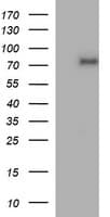 TP73 / p73 Antibody (aa167-409, clone OTI2D2)