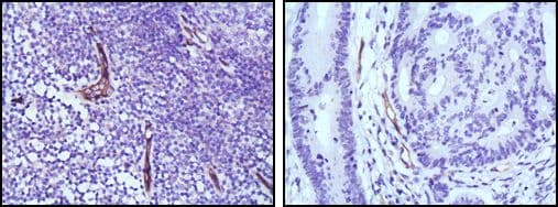 Monoclonal Mouse anti-Human NOS3 / eNOS Antibody (clone 6H2, IHC, WB)