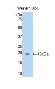 LF / LTF / Lactoferrin Antibody (aa64-193)