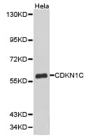 CDKN1C / p57 Kip2 Antibody