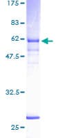 Human NEK6 Protein (Recombinant GST)