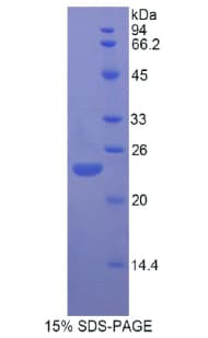 Rat FGF13 Protein (Recombinant His)