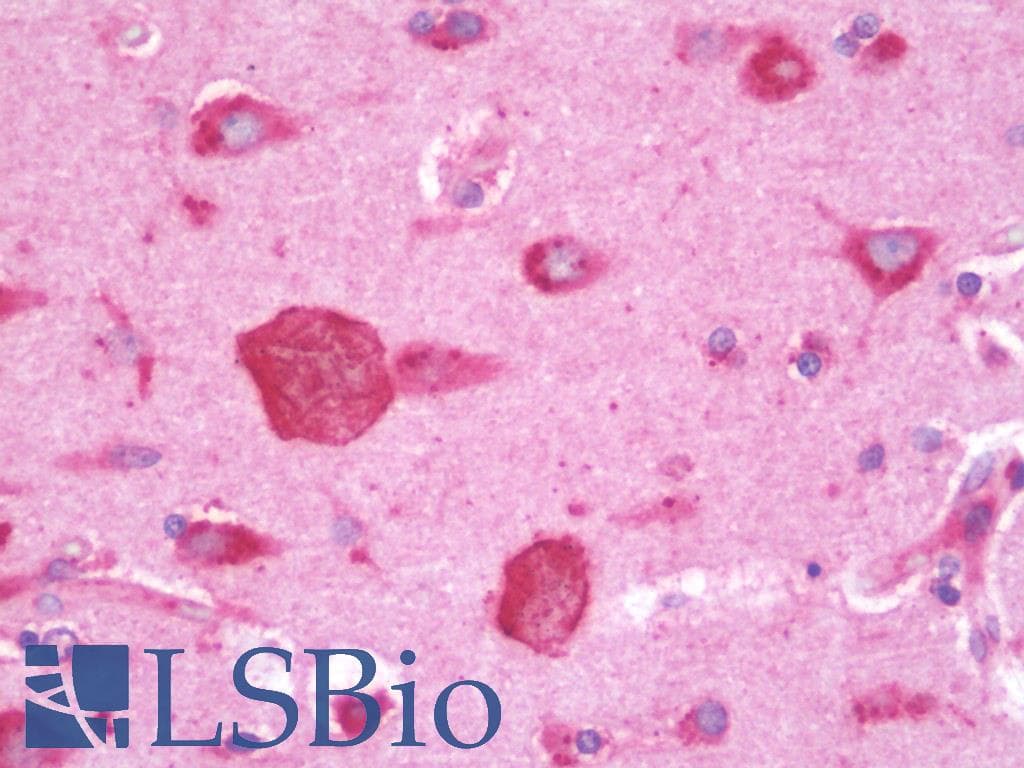 IHC-plus™ Polyclonal Rabbit anti-Human AIMP1 / EMAP II Antibody (IHC, WB)