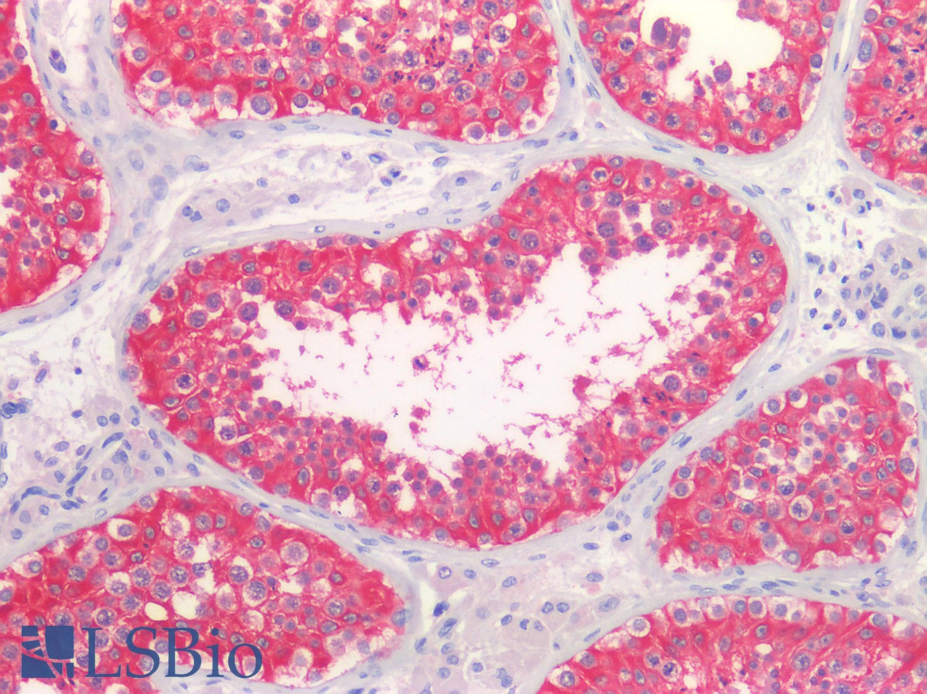 IHC-plus™ Monoclonal Mouse anti-Human G6PD Antibody (clone 2H7, IHC, WB)