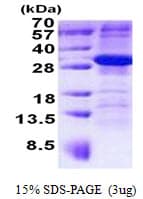 Human ARMC10 Protein (Recombinant His)
