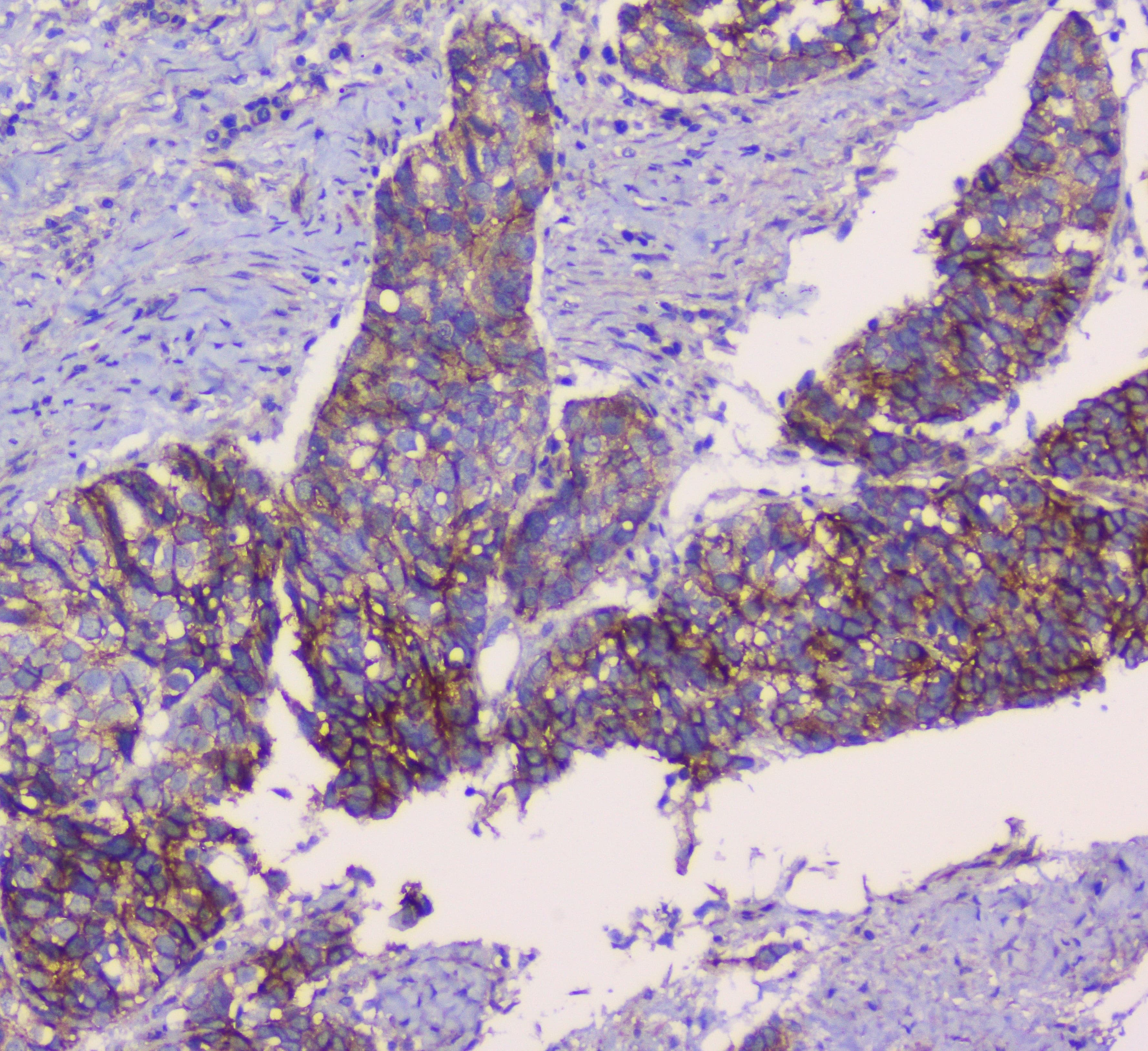 CTNNB1 / Beta Catenin Antibody