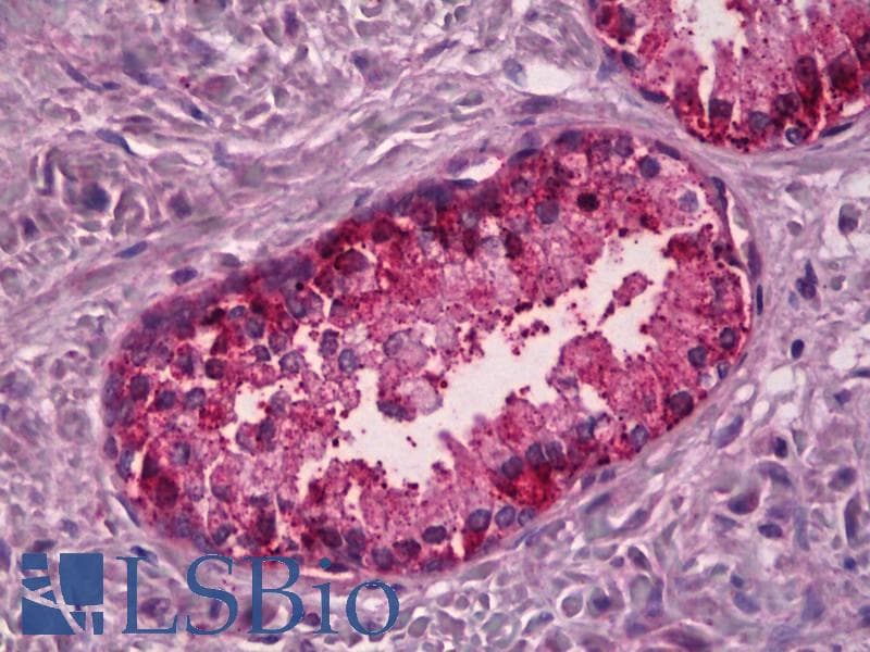 IHC-plus™ PTGER4 / EP4 Antibody