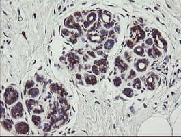 TPD52L3 Antibody (clone OTI8C12)