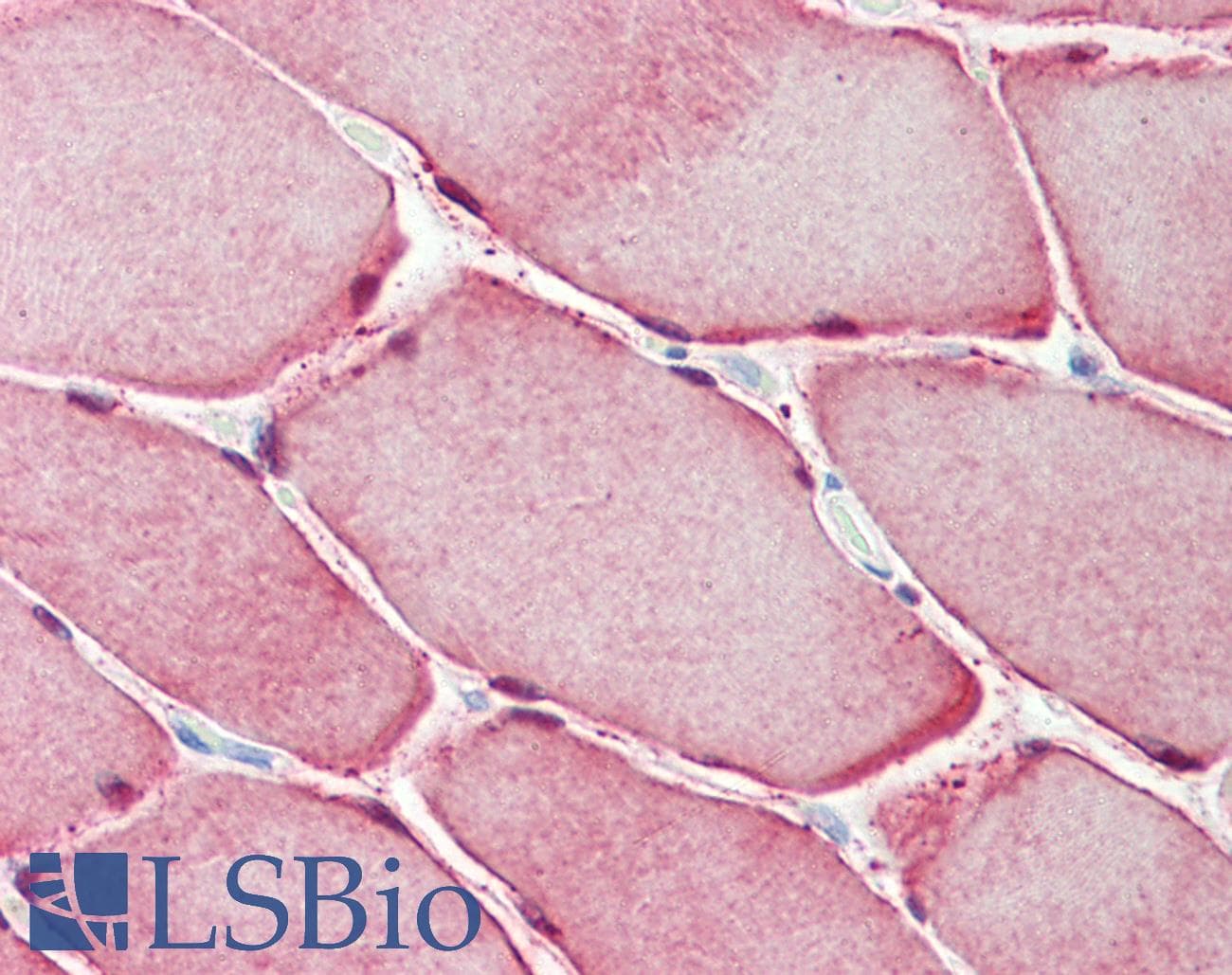IHC-plus™ Polyclonal Rabbit anti-Human CA3 / Carbonic Anhydrase III Antibody (aa17-46, IHC, WB)
