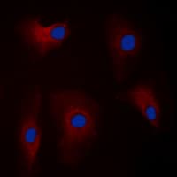 PARK2 / Parkin 2 Antibody (Internal)