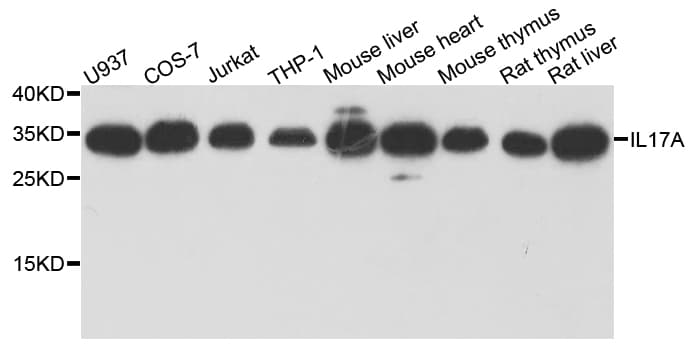 Polyclonal Rabbit anti-Human IL17A Antibody (WB)