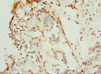 CSNK1G1 / CKI-Gamma 1 Antibody