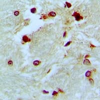 POLDIP3 / p46 Antibody