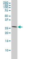 IHC-plus™ Monoclonal Mouse anti-Human PHAP1 / ANP32A Antibody (clone 2G11-4A5, IHC, IF, WB)