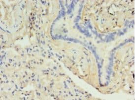 DRD5 / Dopamine Receptor D5 Antibody (aa361-477)