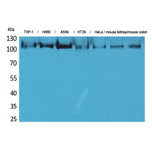cPLA2 Antibody (21-70 aa, N-terminal)