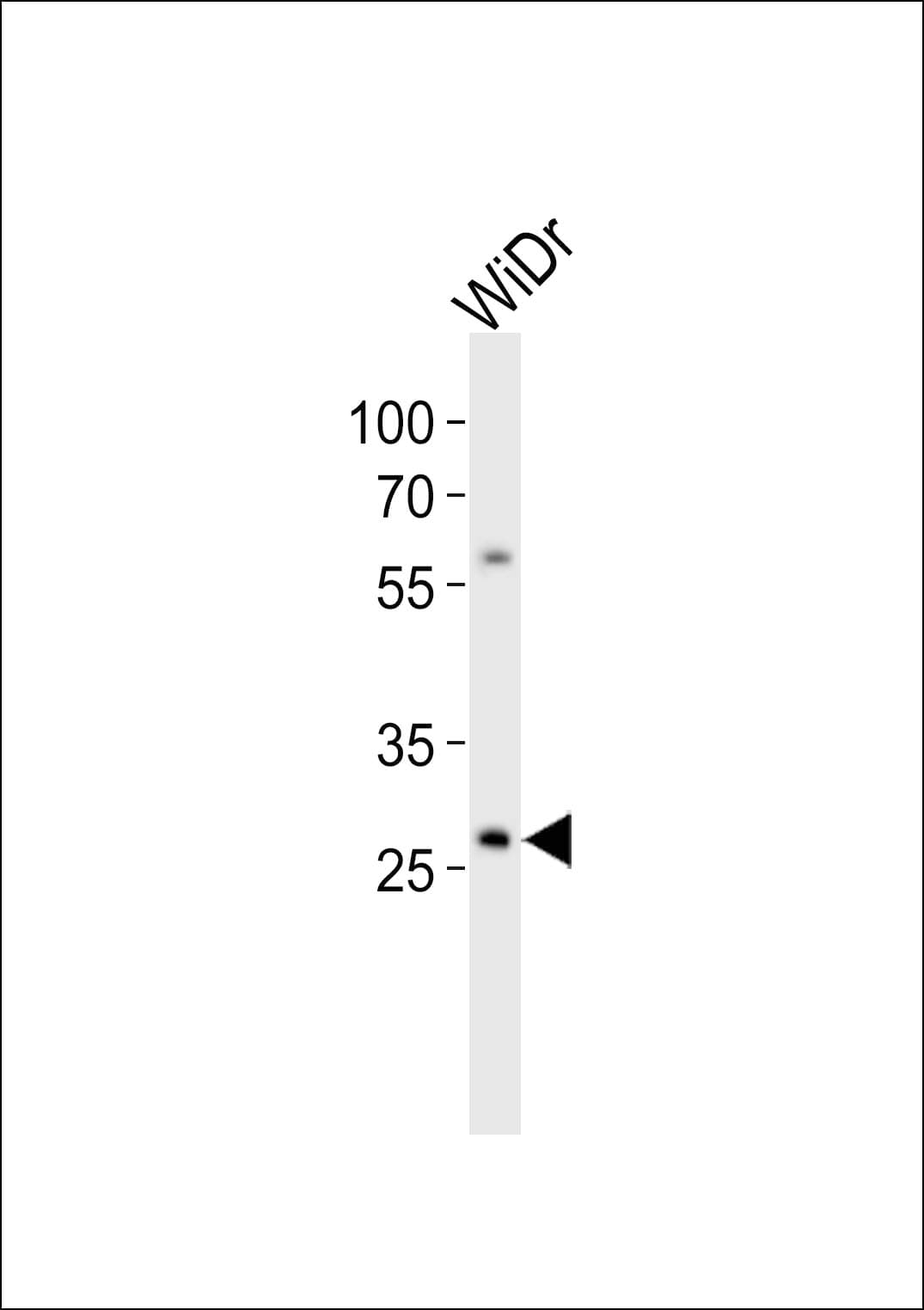 COX11 Antibody (aa262-296)