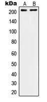 Polyclonal Rabbit anti-Human ITGB4 / Integrin Beta 4 Antibody (C-Terminus, IHC, WB)