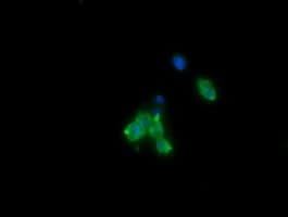 CTAG1B / NY-ESO-1 Antibody (clone OTI2G2, Carrier-free)