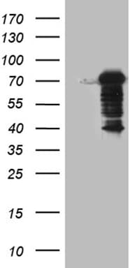 DCP1B Antibody (aa167-473, clone OTI1B5)