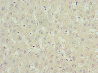 USP15 Antibody