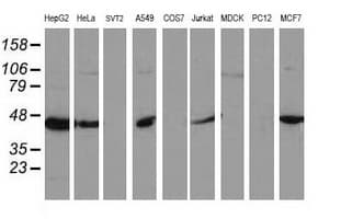 ARFGAP1 Antibody (clone OTI2D5)