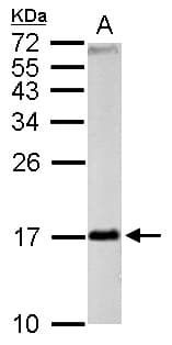 Polyclonal Rabbit anti-Human FIS1 Antibody (aa1-152, IHC, WB)
