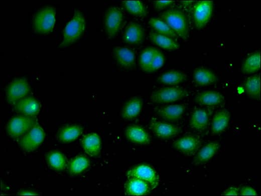 ADCK4 Antibody