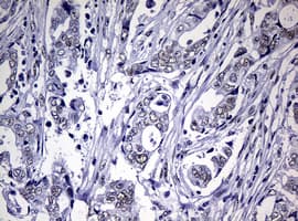 NBN / Nibrin Antibody (clone OTI2E10)