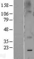 CAV2 / Caveolin 2 Protein (Over-Expression Lysate Myc-DDK (Flag))